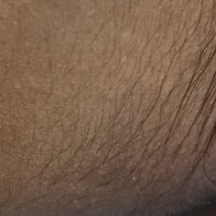 Vibha skin
