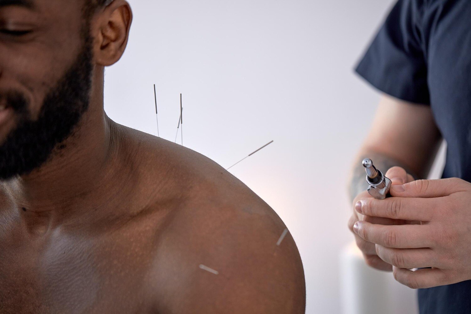 Needling or Exercise for Sports Injury Prevention in Bellandur