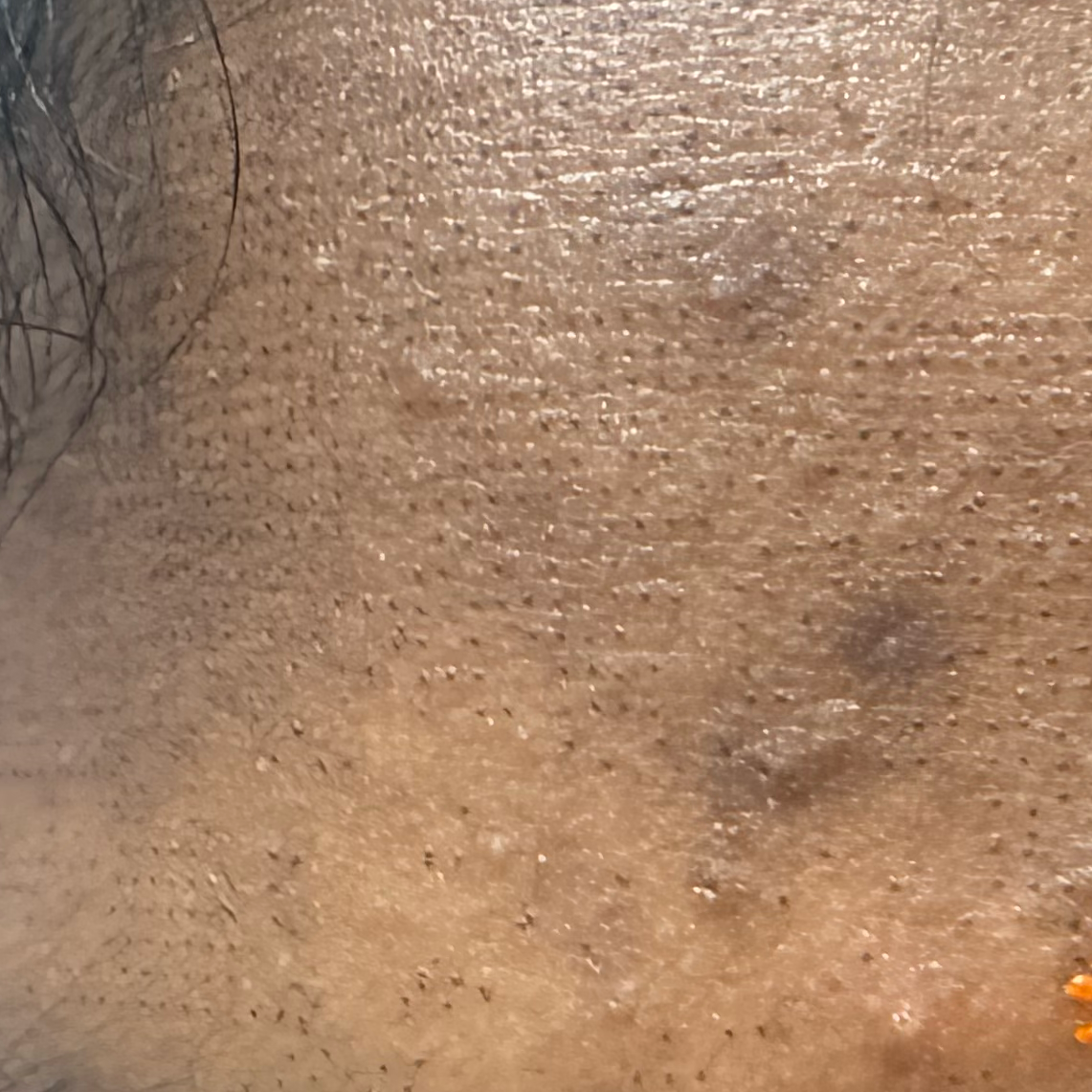 Vibha skin