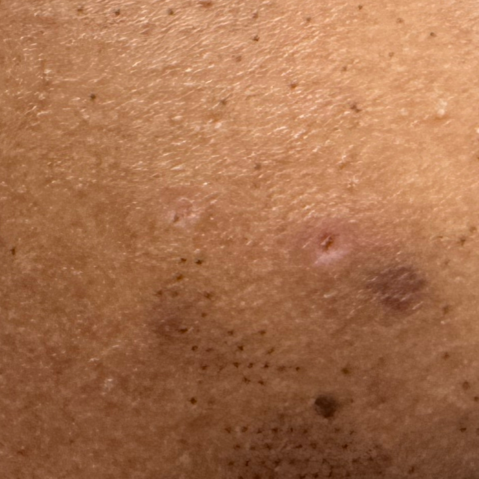 Vibha skin