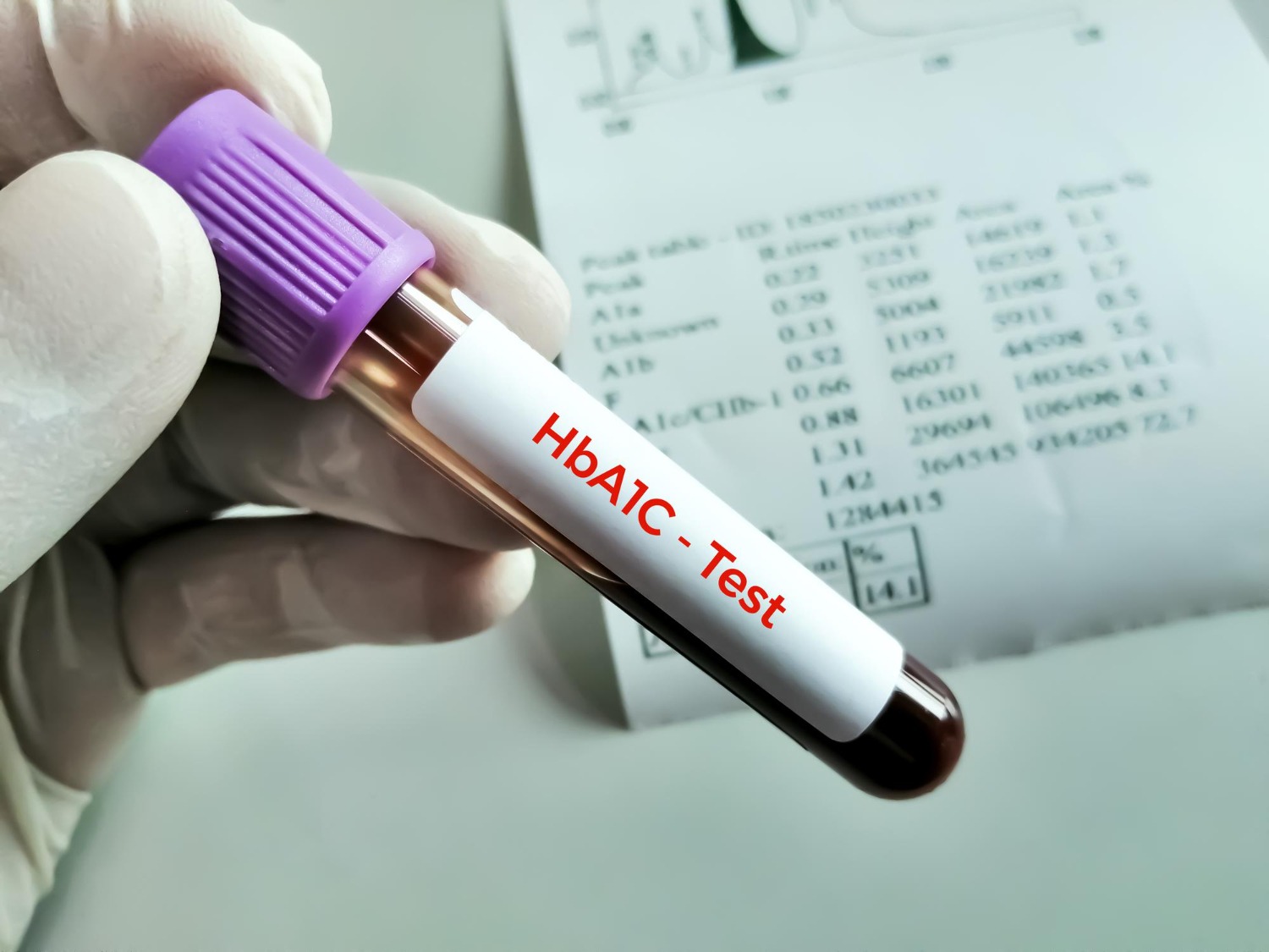 Why HbA1c May Stay High Even When Daily Sugar Readings Look Normal