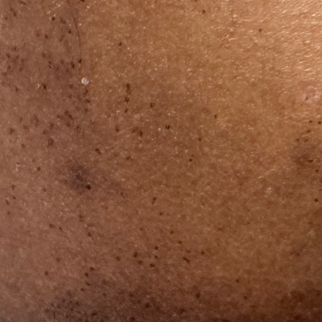 Vibha skin