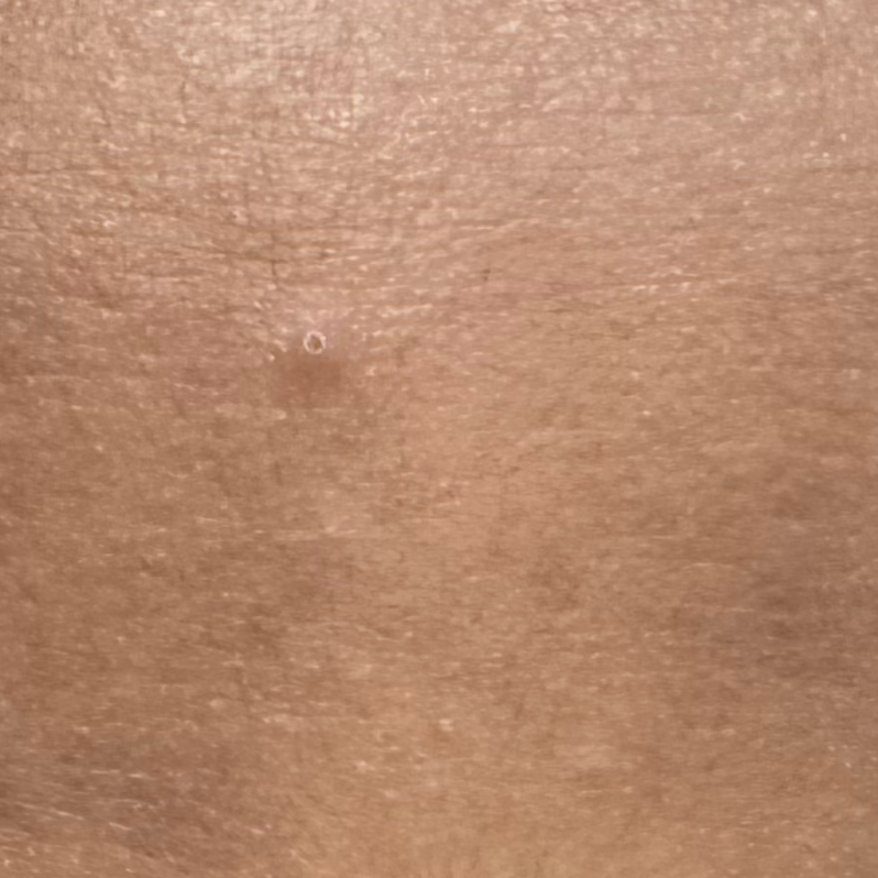 Vibha skin