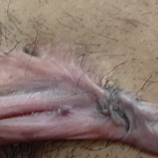Vibha skin