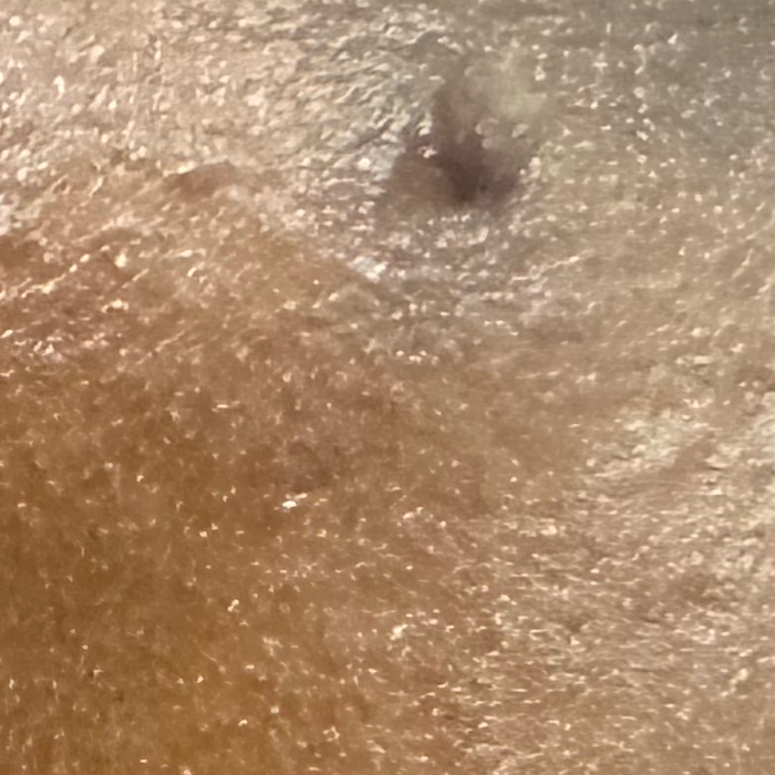Vibha skin