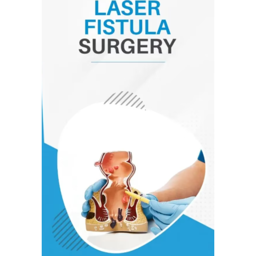 Laser Fistula Surgery in Vithalwadi What Should Be Checked Before Choosing Treatment