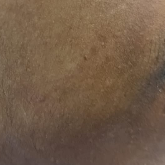 Vibha skin