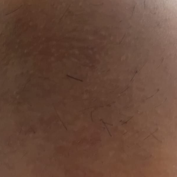 Vibha skin