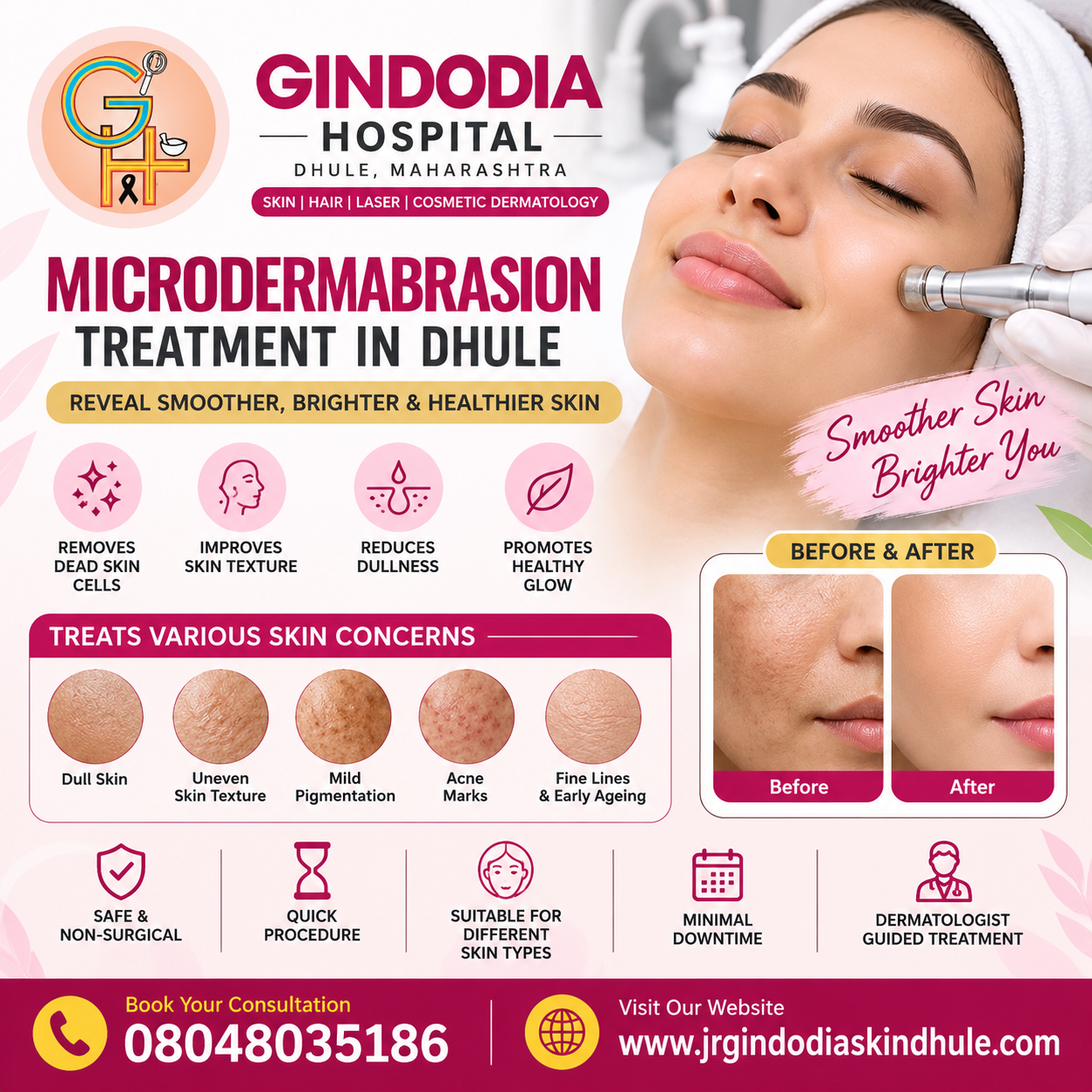 Microdermabrasion Treatment in Dhule | Gindodia Hospital