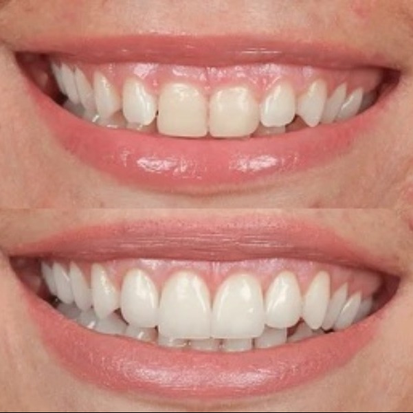 Affordable Dentist in Vikaspuri