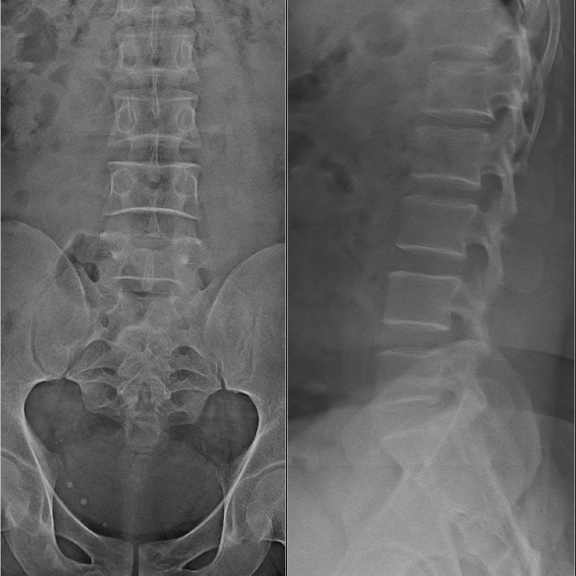 Spine Care