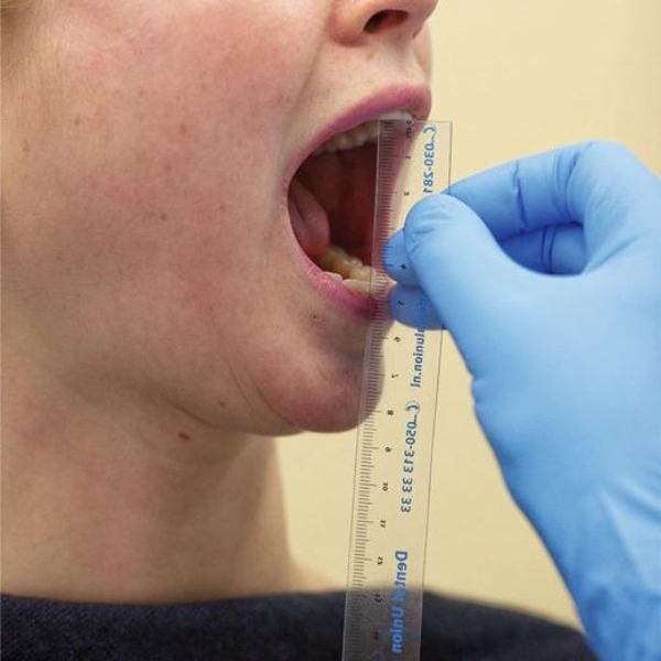 TMJ Disorder Diagnosis in Wakad | Jaw Joint Examination