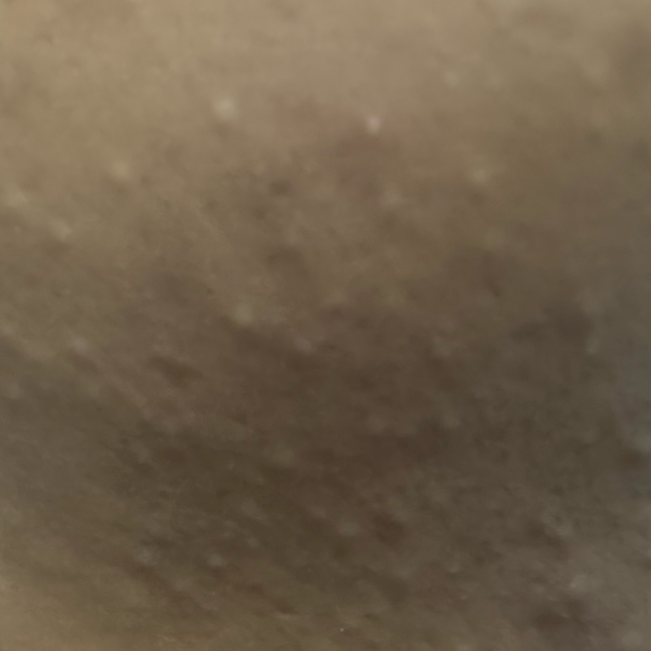 Vibha skin