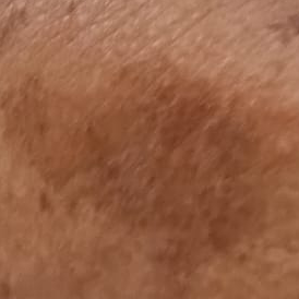Vibha skin