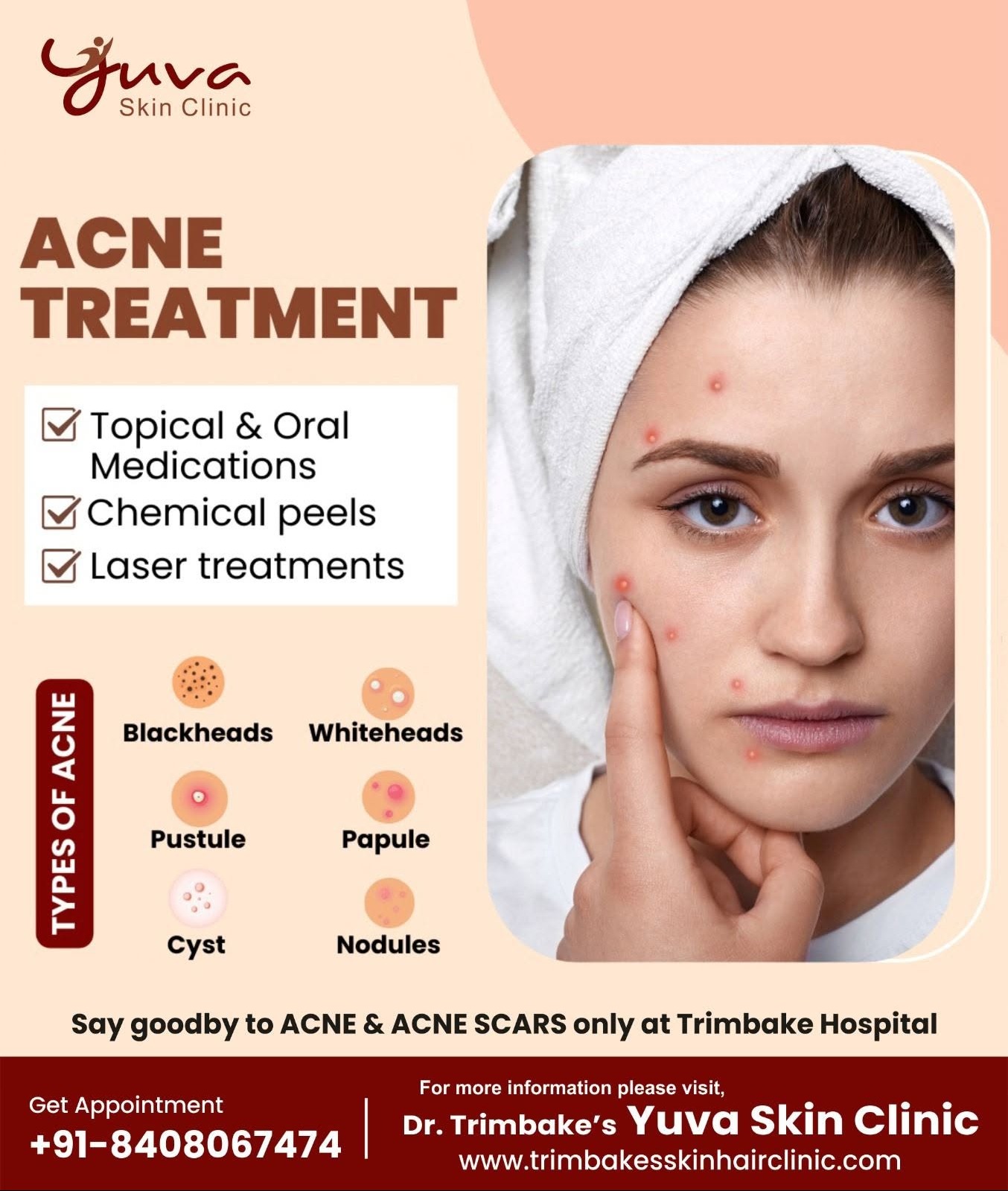 🌟 Say Goodbye to Acne! 🌟
Struggling with acne? Get clear, glowing skin with expert Acne Treatment ...