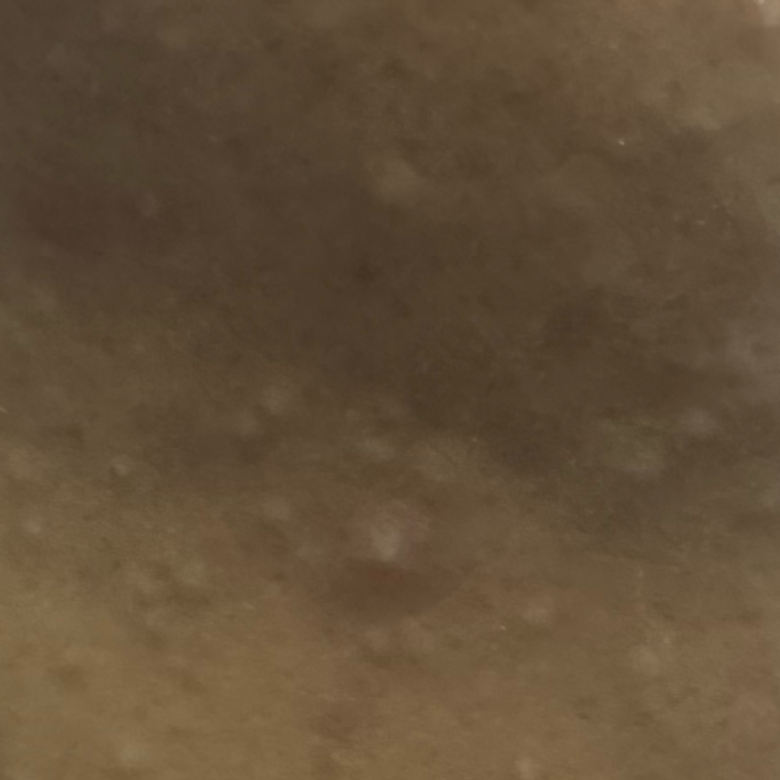 Vibha skin