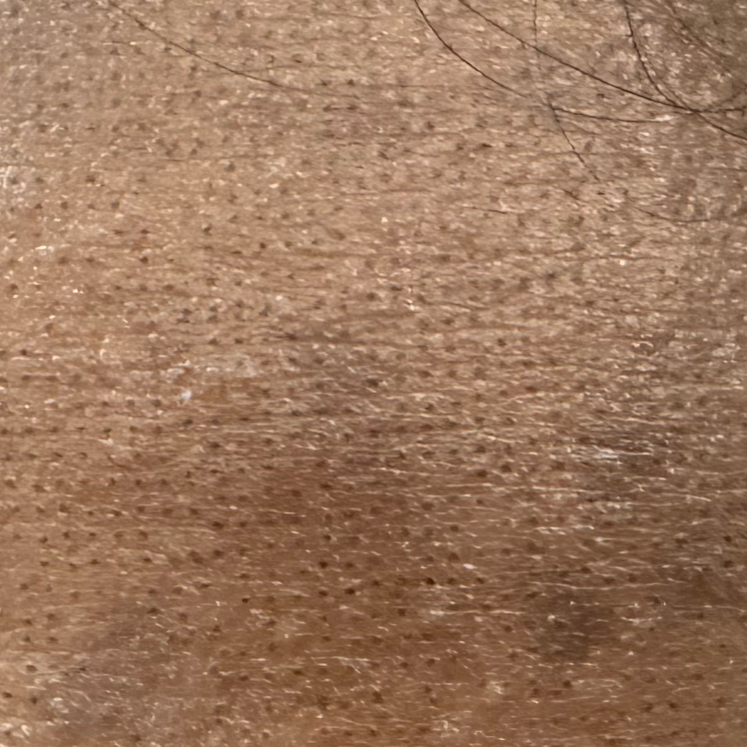 Vibha skin