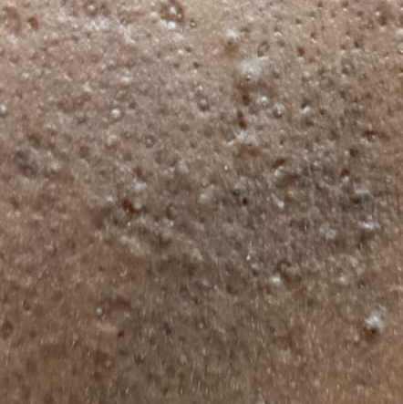 Vibha skin