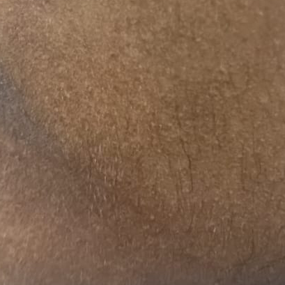 Vibha skin
