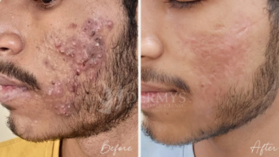 Skin Doctor in Ashok Vihar
