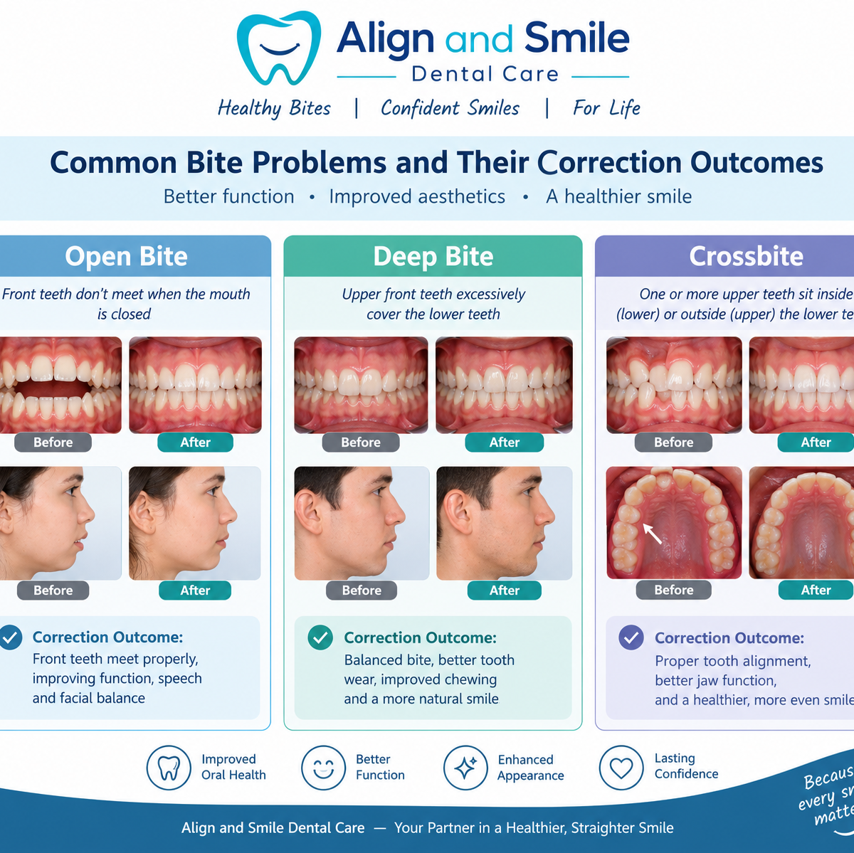 Bite Correction: Understanding Overbite, Open Bite and Crossbite
By Dr. Ruchi Saxena, Orthodontist
