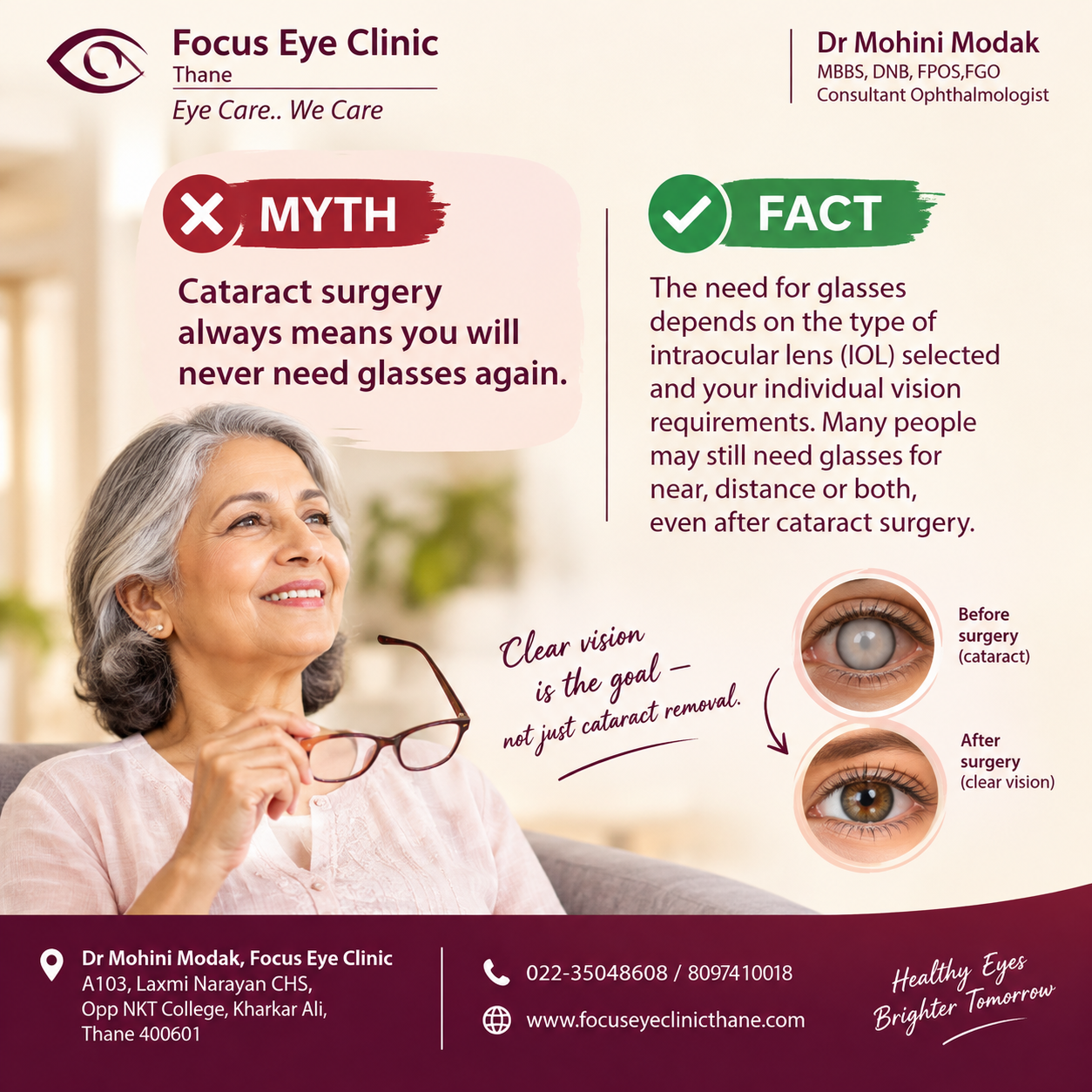 Myth vs Fact: Will You Never Need Glasses After Cataract Surgery? ποΈ