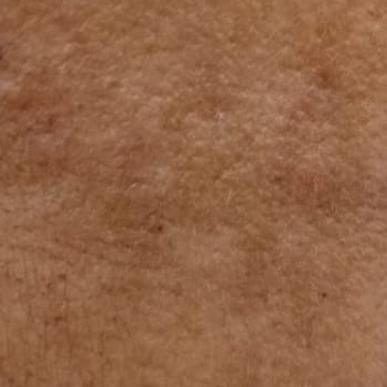 Vibha skin