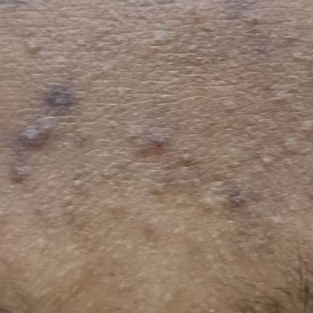Vibha skin