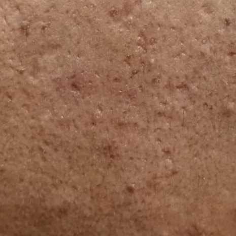 Vibha skin