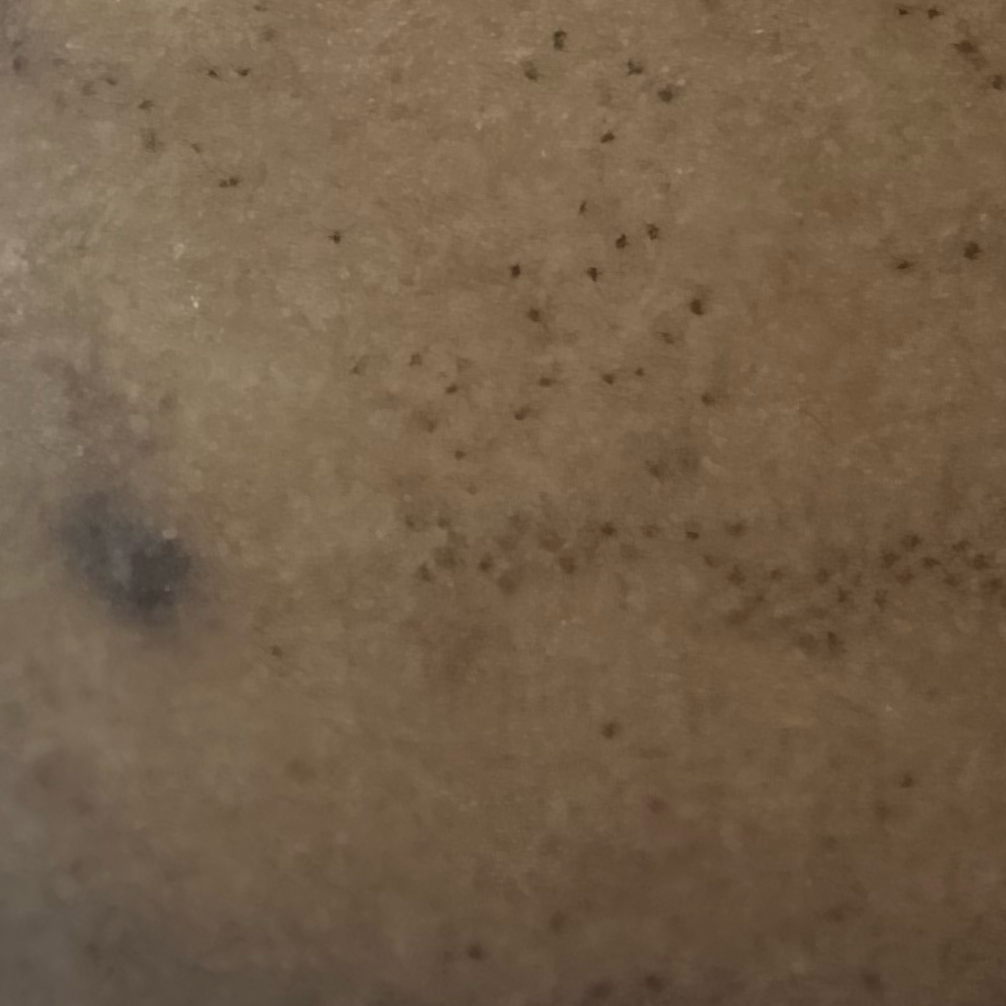 Vibha skin