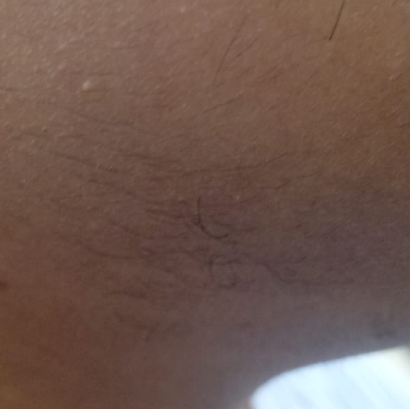 Vibha skin