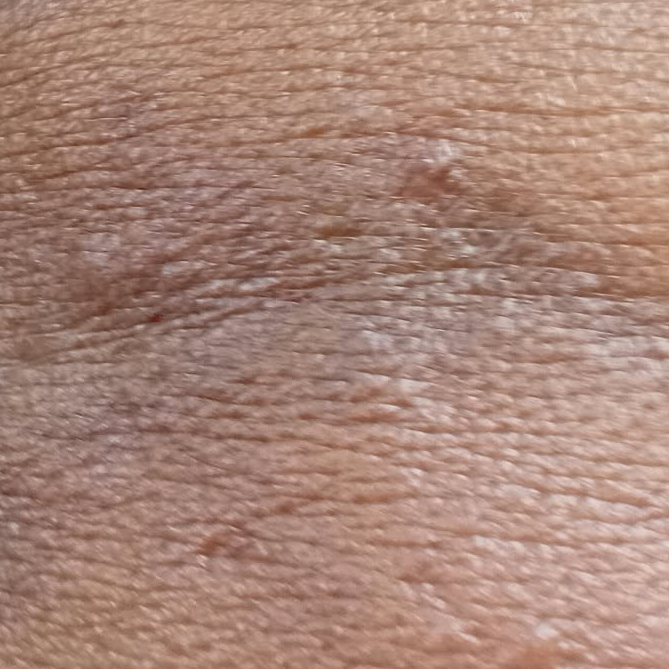 Vibha skin