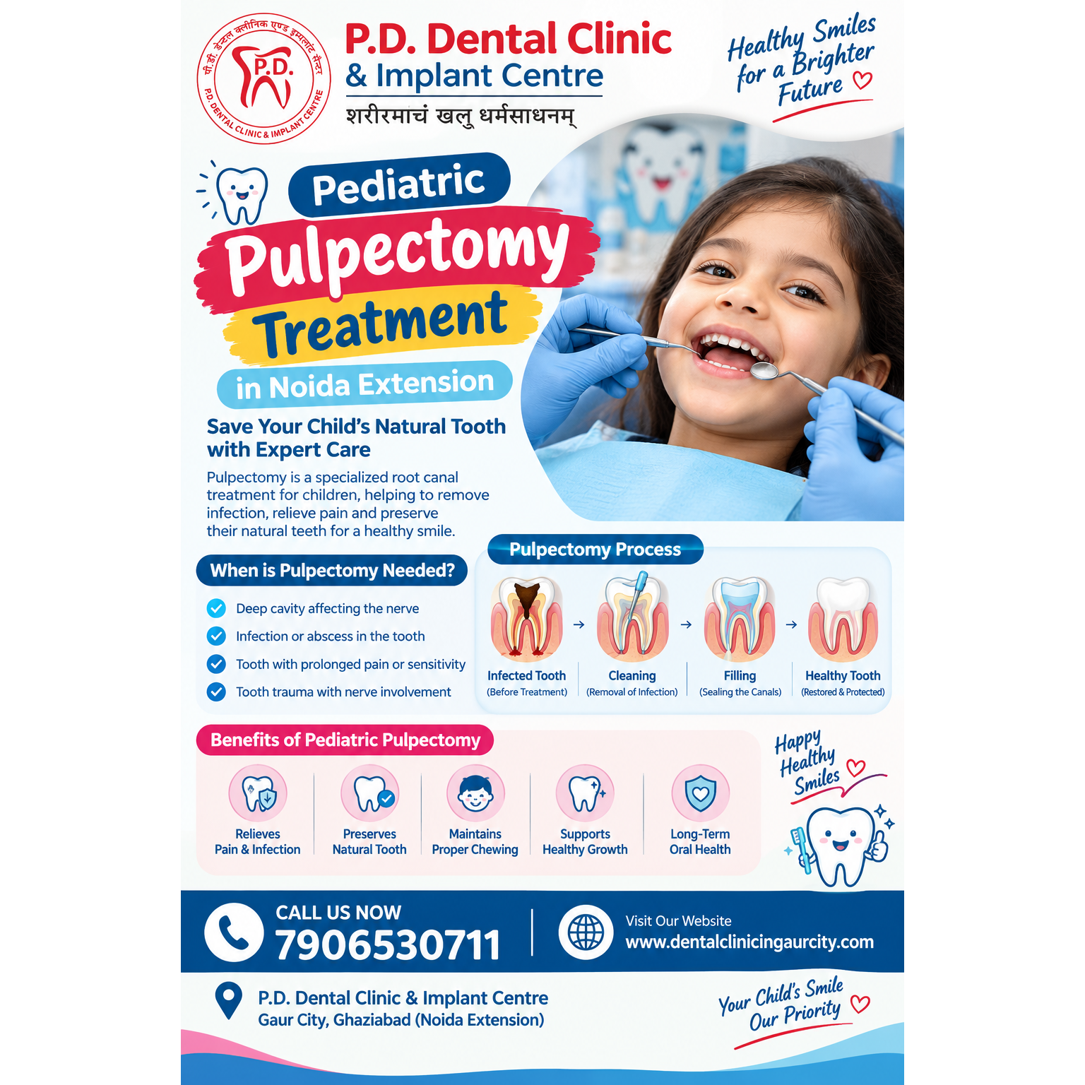 Pediatric Pulpectomy Treatment in Noida Extension | P.D. Dental Clinic