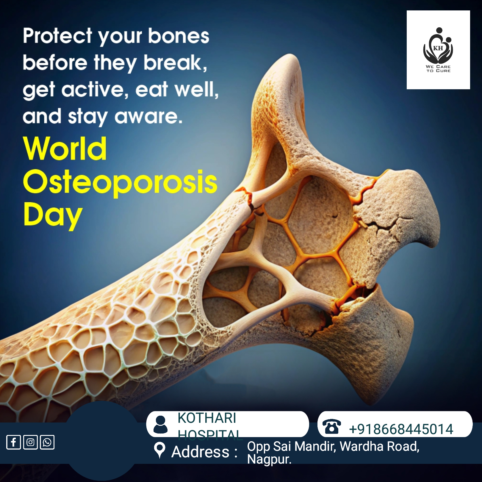 Osteoprosis