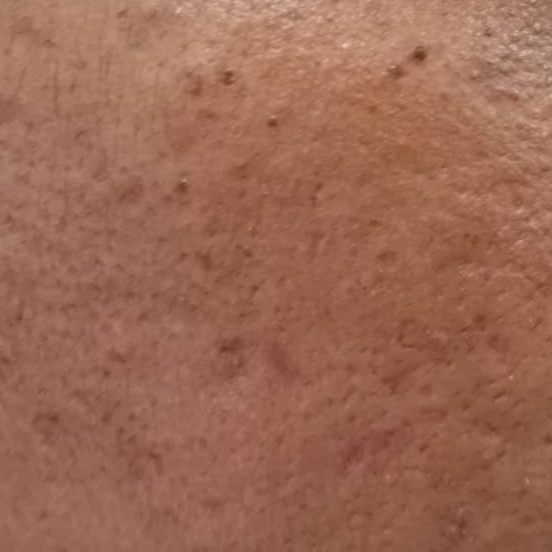 Vibha skin