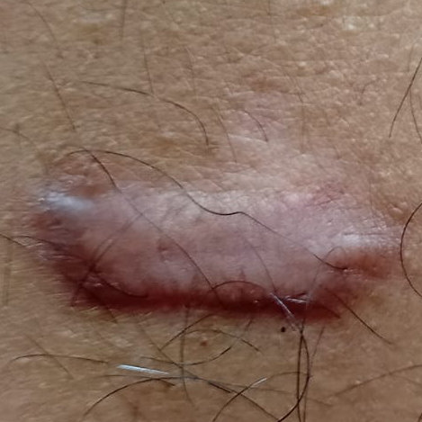 Vibha skin