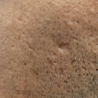 Vibha skin