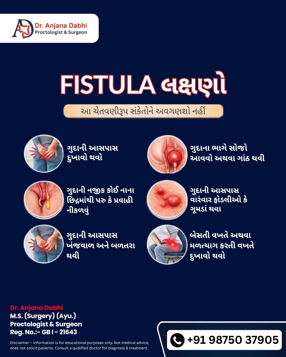 Fistula Symptoms: Know the Warning Signs!
