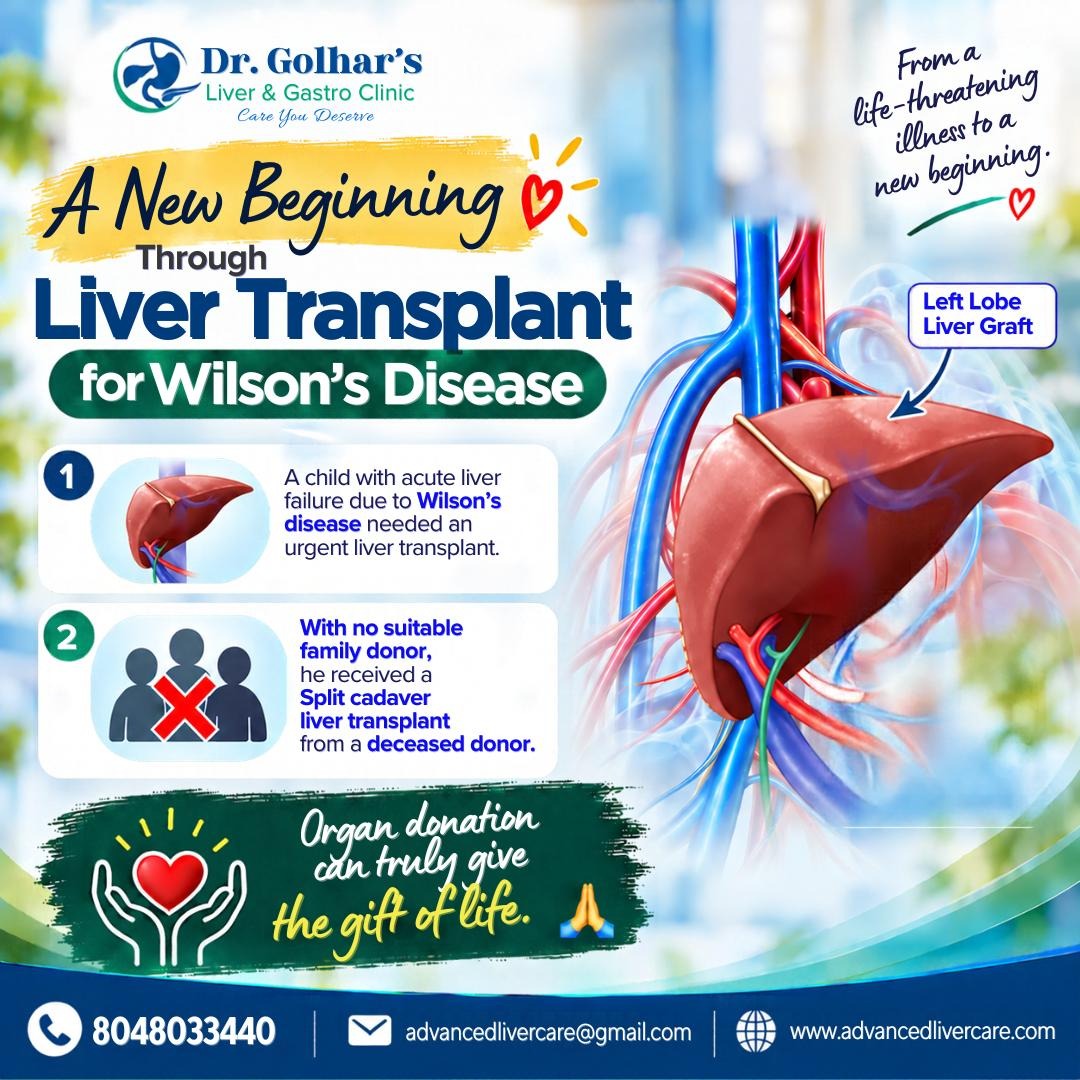 A New Beginning Through Liver Transplant for Wilson’s Disease