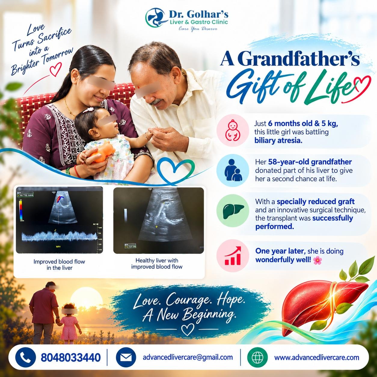 Liver transplant for Biliary atresia in Mumbai