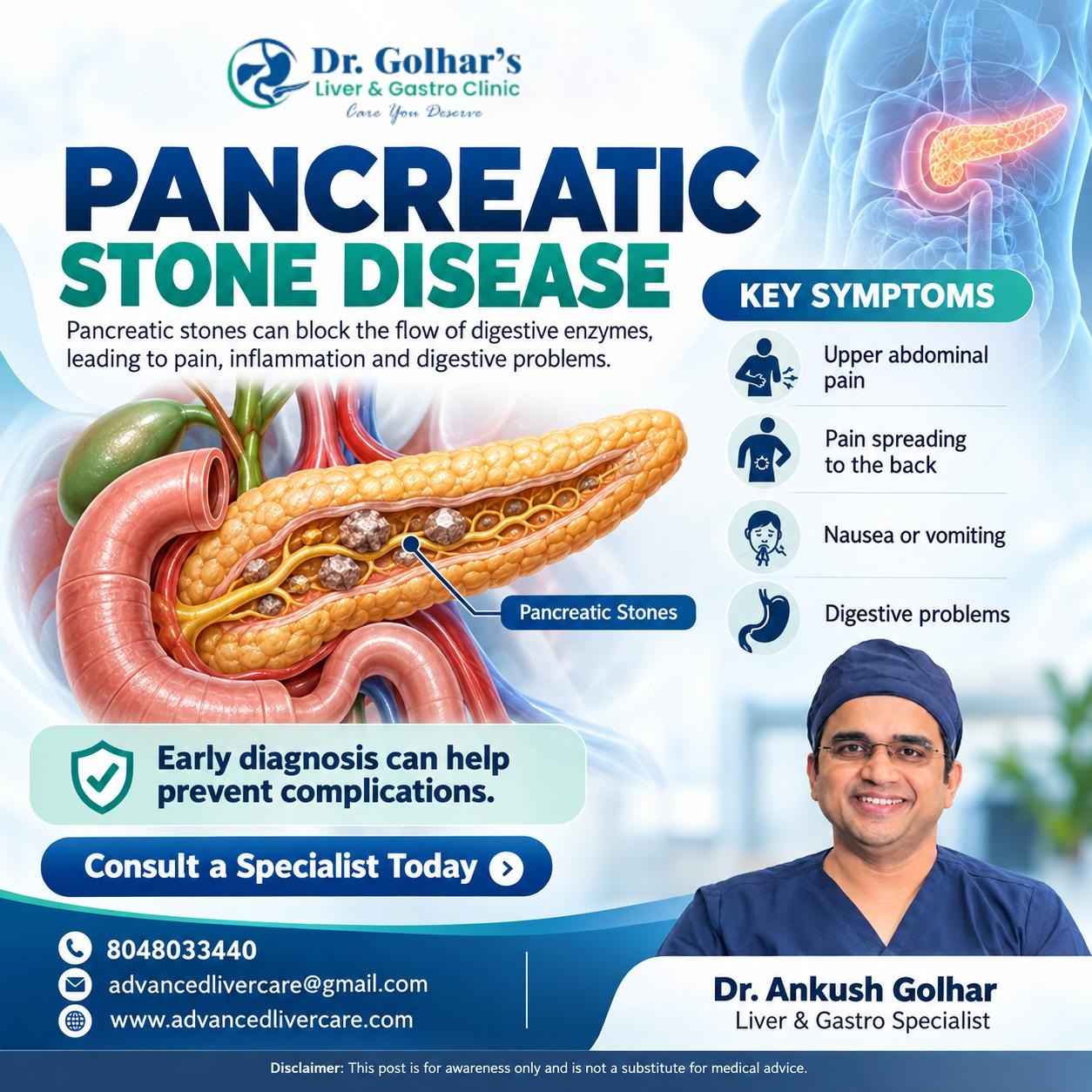Pancreatic stone disease Treatment in Mumbai