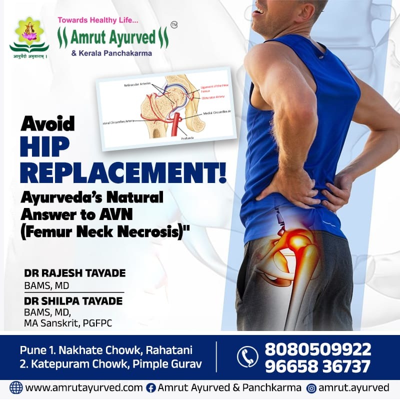 Best Treatment for Hip joint Pain - Avascular Necrosis  main image