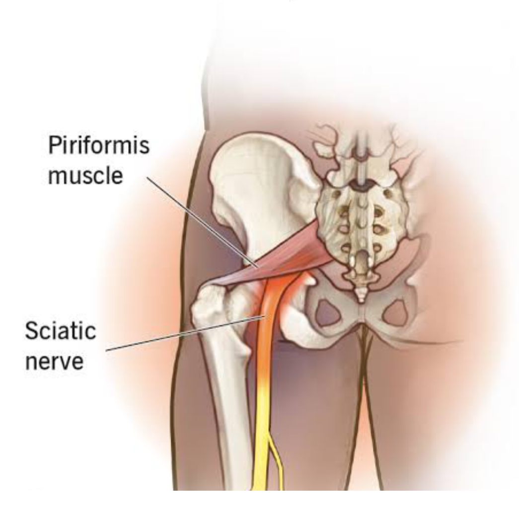 pain relief
