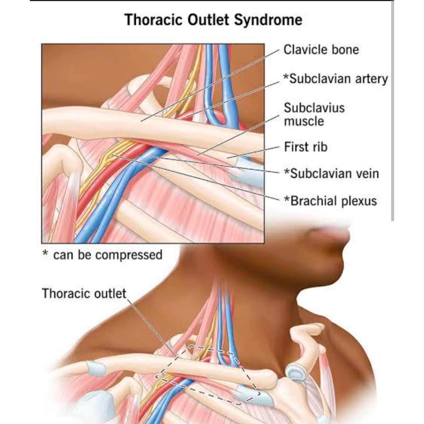 neck pain relief new friends c