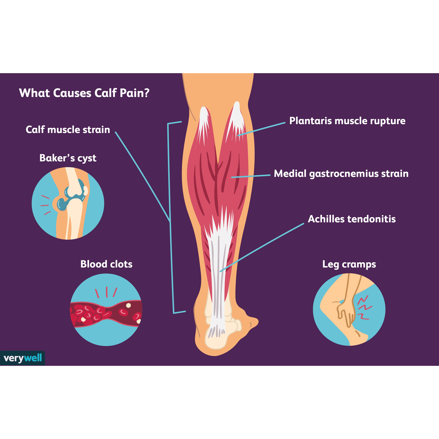 calf muscles