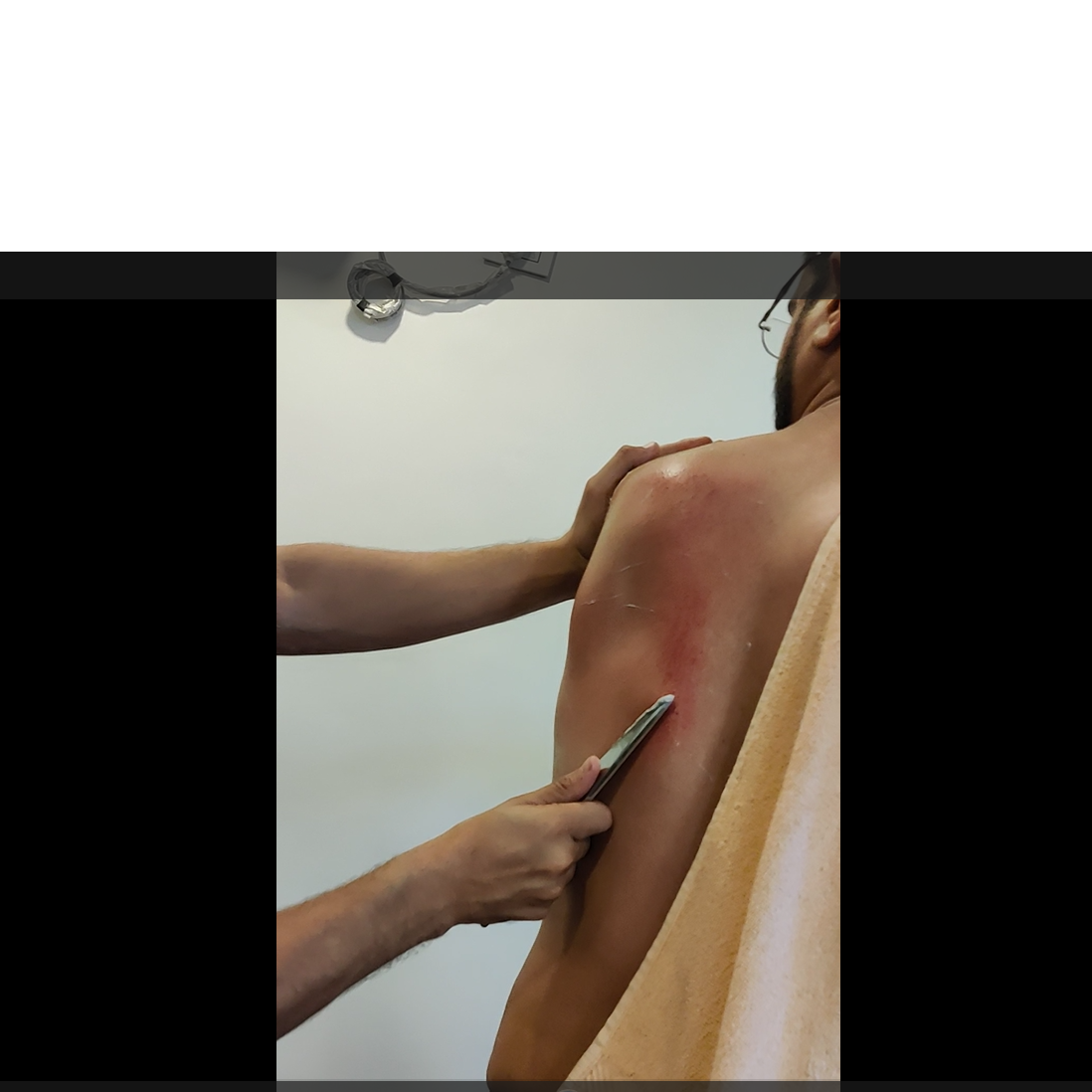 preventing knee pain recurrenc