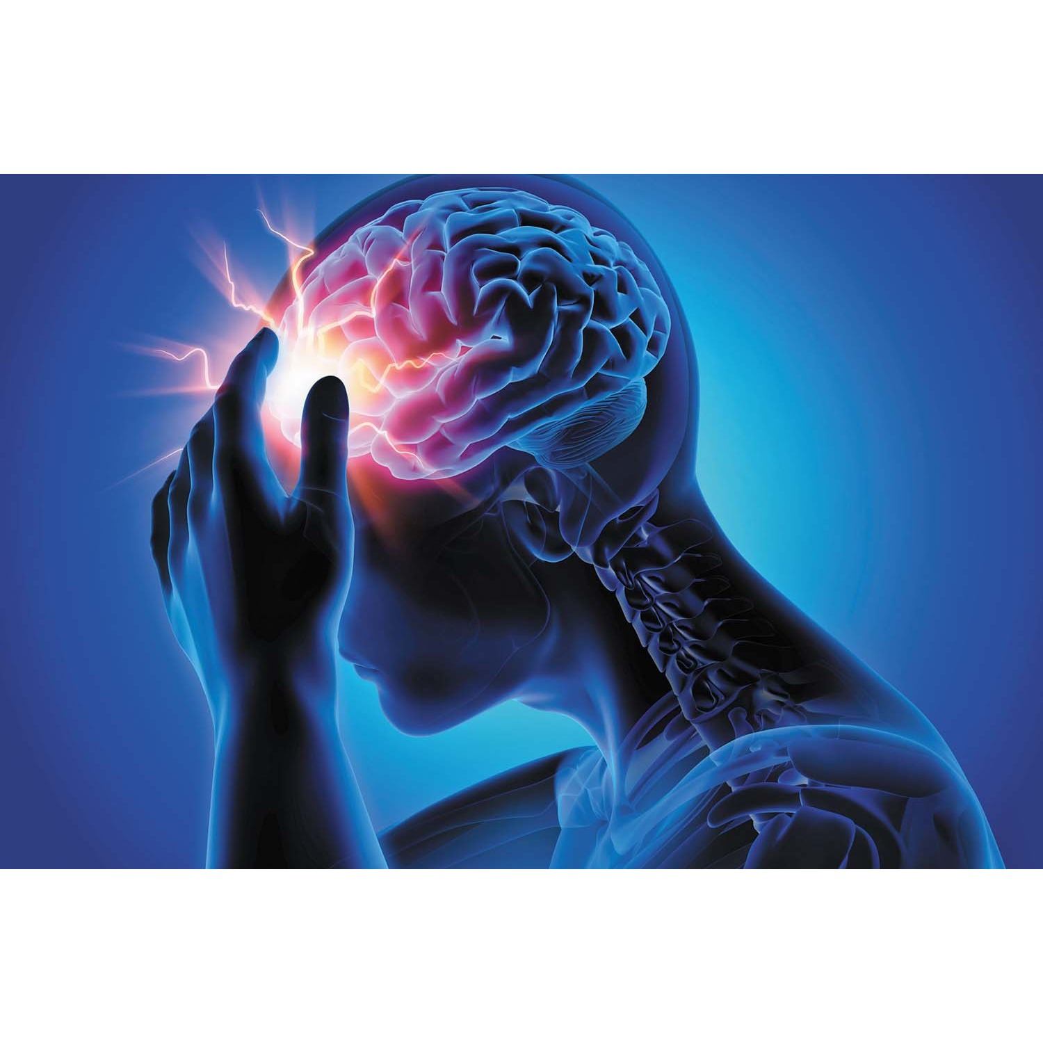 stroke treatment