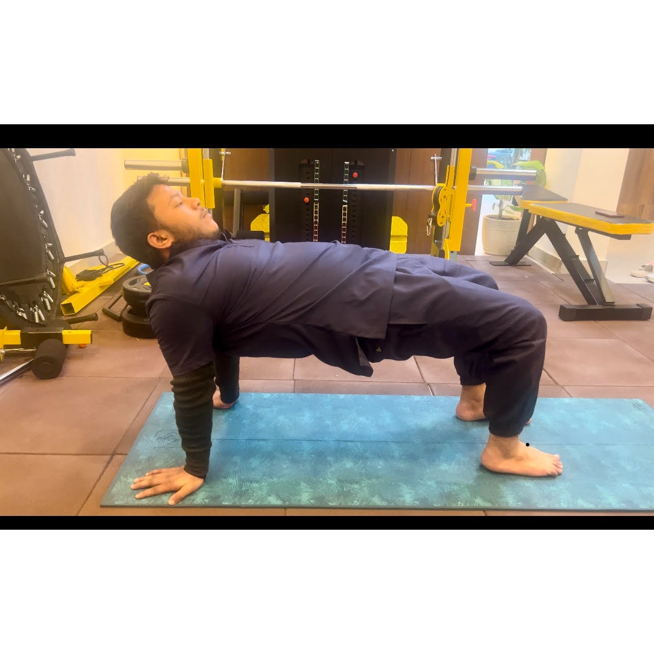 lumbar puncture