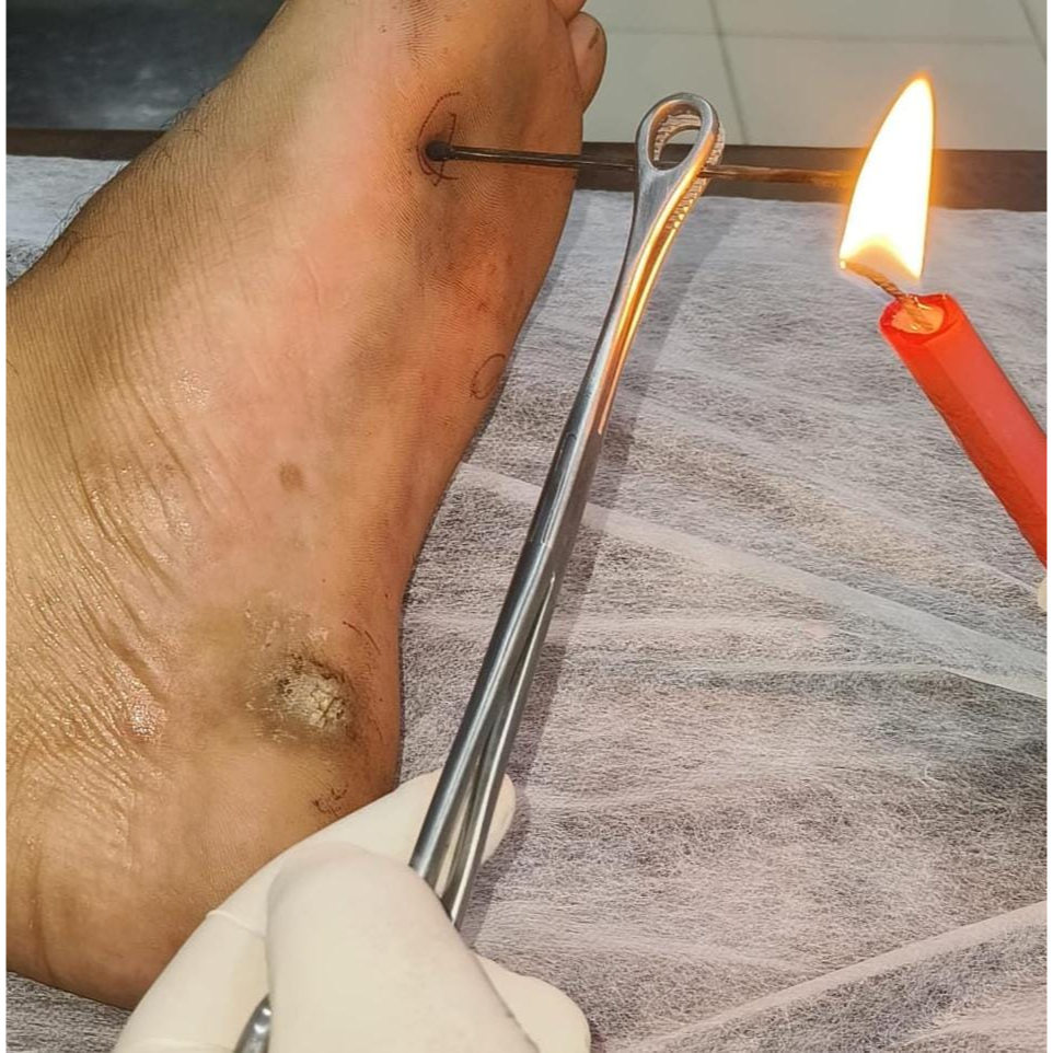 update image
