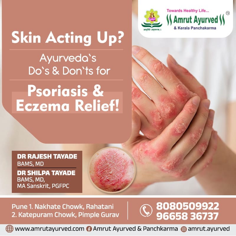 Best Ayurvedic treatment for Psoriasis & Eczema Relief! in pune main image